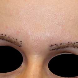 Eyebrows Before & After Patient #6300